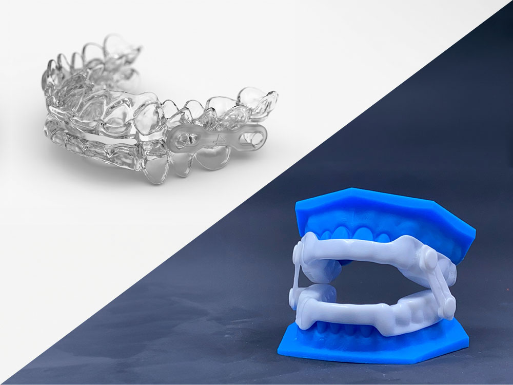 Common Questions about Airway Orthodontics Common Questions about Airway Orthodontics in Utah