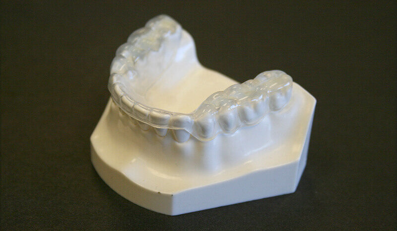 Custom oral appliance on a dental model