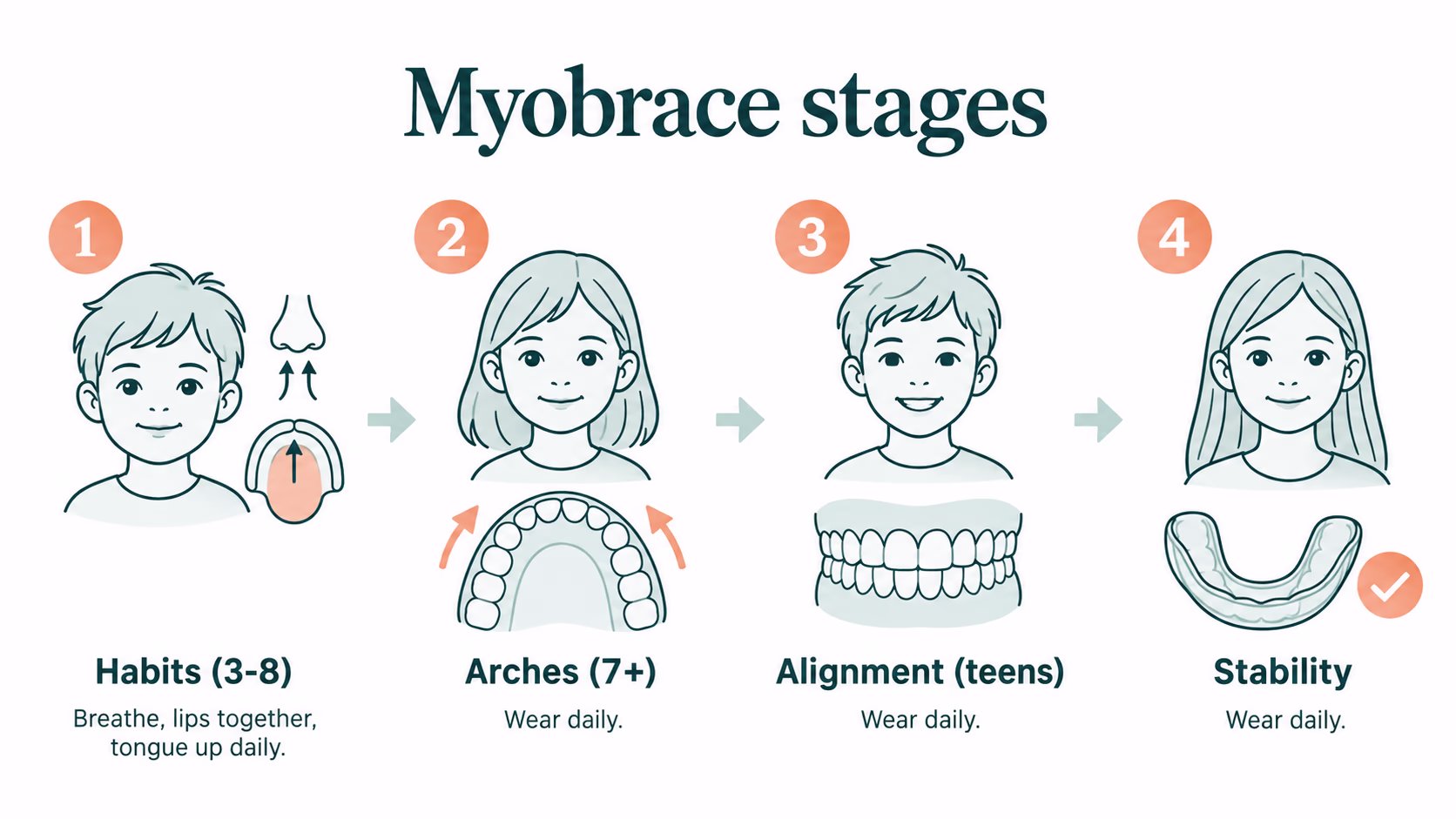 Timeline illustration of the four Myobrace treatment stages: habits, arches, alignment and stability