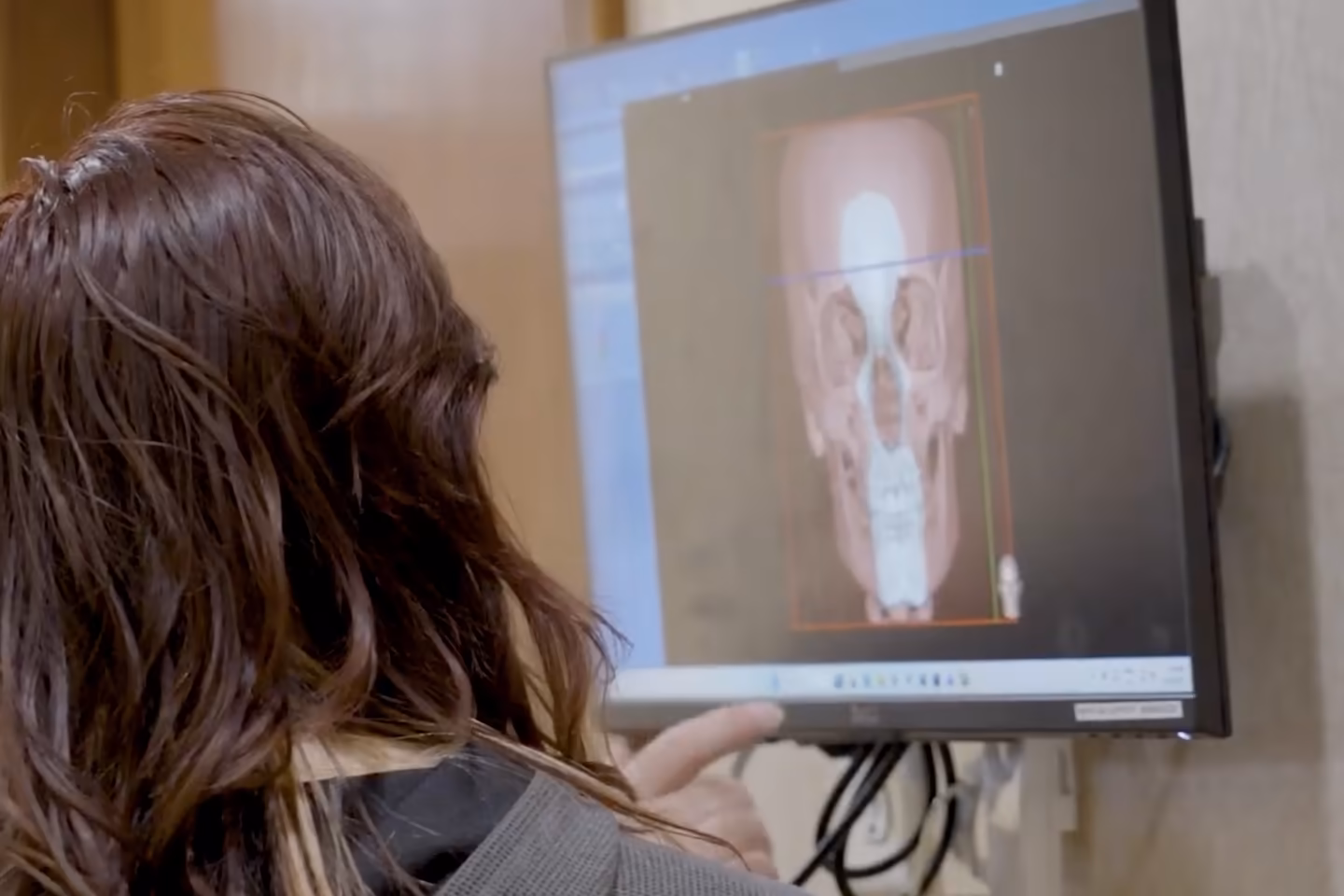 A patient looking at her own 3D airway and jaw scan on the monitor during her evaluation