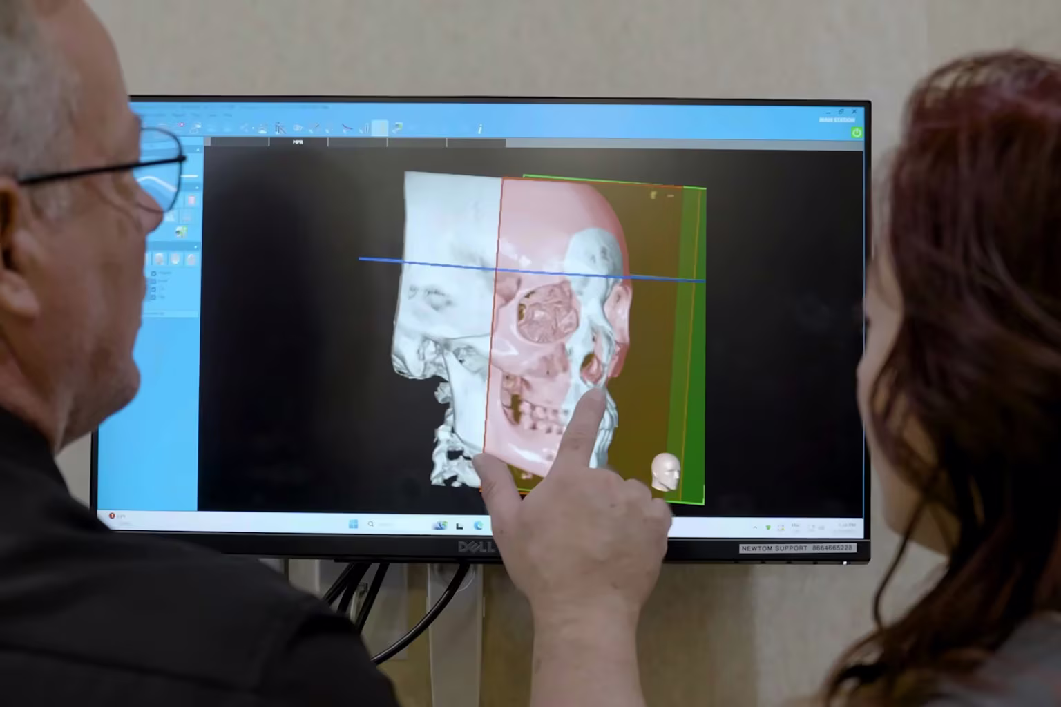 Dr. K. Cheyn Gunnerson pointing out a finding on a 3D jaw scan while a patient looks on